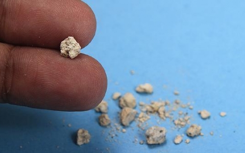 结石卡在膀胱内壁疼吗