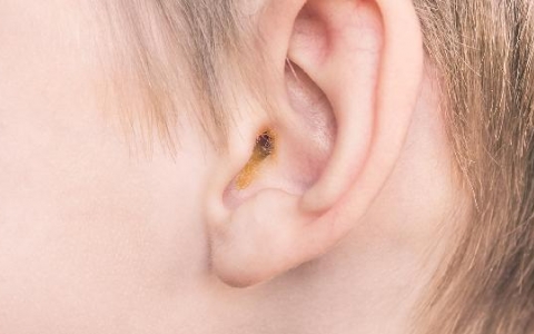 儿童听力减退可以恢复吗