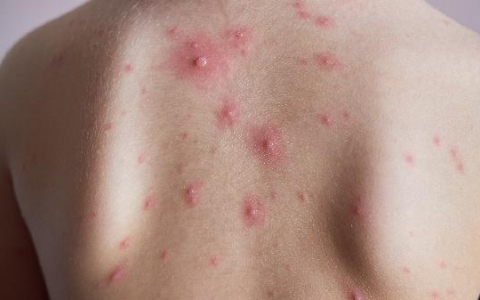 孩子过敏性鼻炎是怎么引起的呢