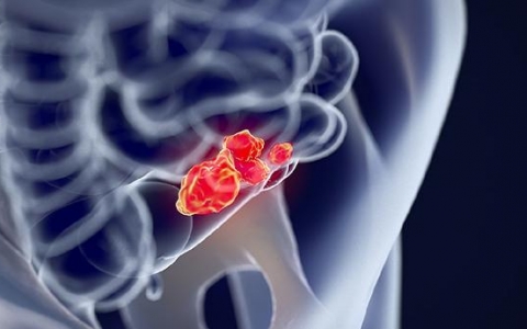 儿童粘液腺囊肿怎么治疗