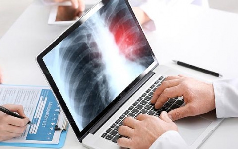 粘液性肺腺癌恶性程度高吗