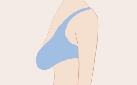 做乳房下垂矫正修复能维持多久