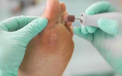 18岁后扁平足还能矫正吗