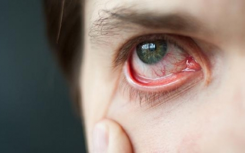 眼睑外翻矫正手术的方法是什么？