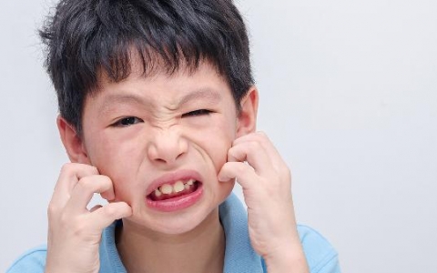 荨麻疹是怎么引起的,如何治