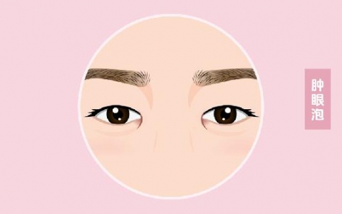 做抽脂消除肿眼泡的步骤及注意事项