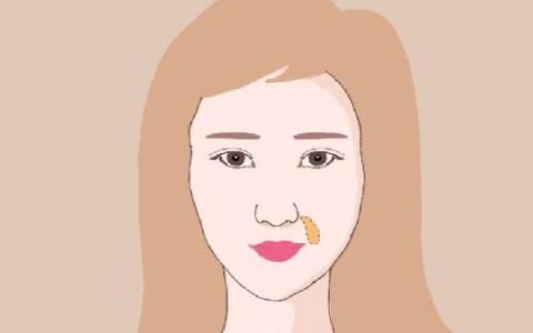 做膨体垫鼻基底大概多少钱？
