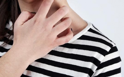 屁股上的湿疹怎么治疗好的快