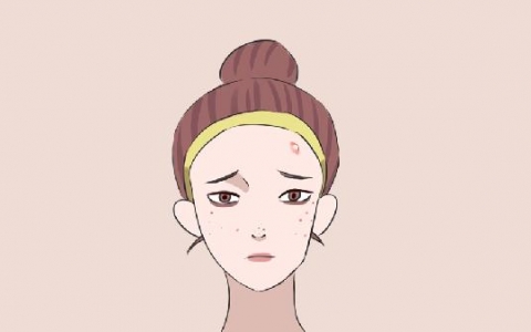 脉冲光去痘印手术需要注意什么？