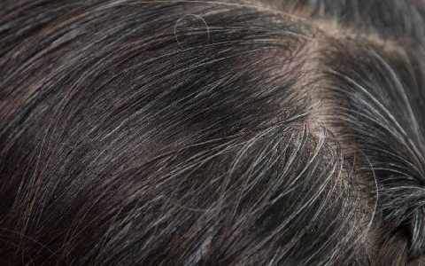 白头发越拔越多是真的吗?