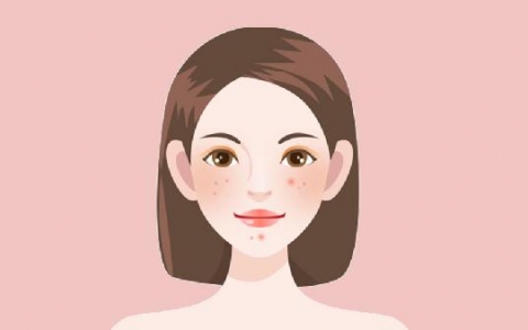 女外阴长了个大痘像粉刺怎么办?