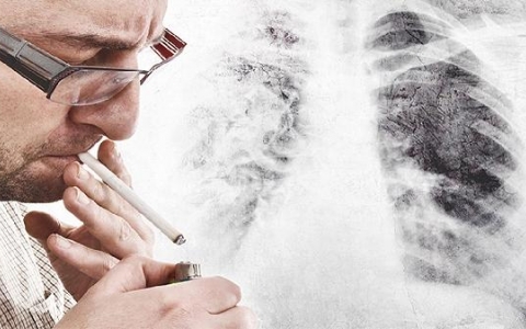 肺癌中医辨证论治方剂有哪些