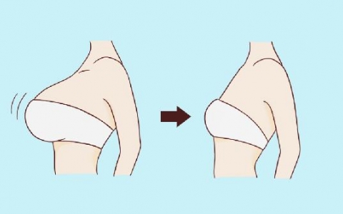 做半侧切除法乳头缩小流程是怎样的