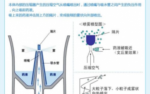 什么样需要做雾化治疗_哪些情况适用雾化治疗