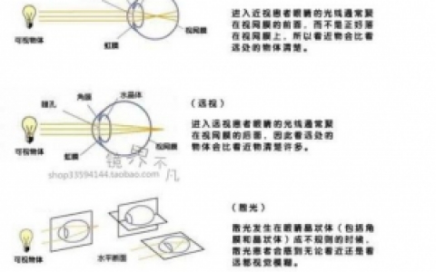 近视眼怎么慢慢恢复视力