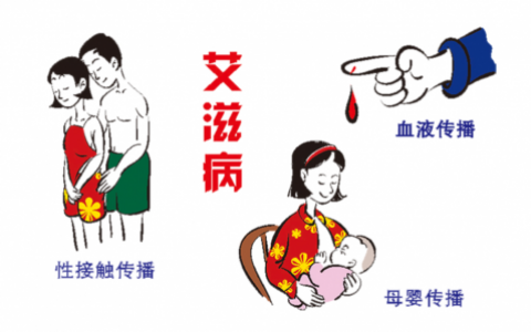 艾滋病传播方式有几种